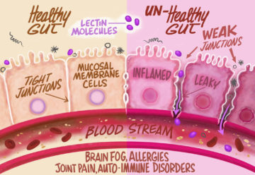 Lectins and our intestine