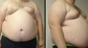 OBESITY IT IS NOT ALL OUR FAULT