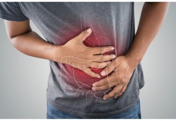 COLON IRRITABILE E DIETA FODMAP